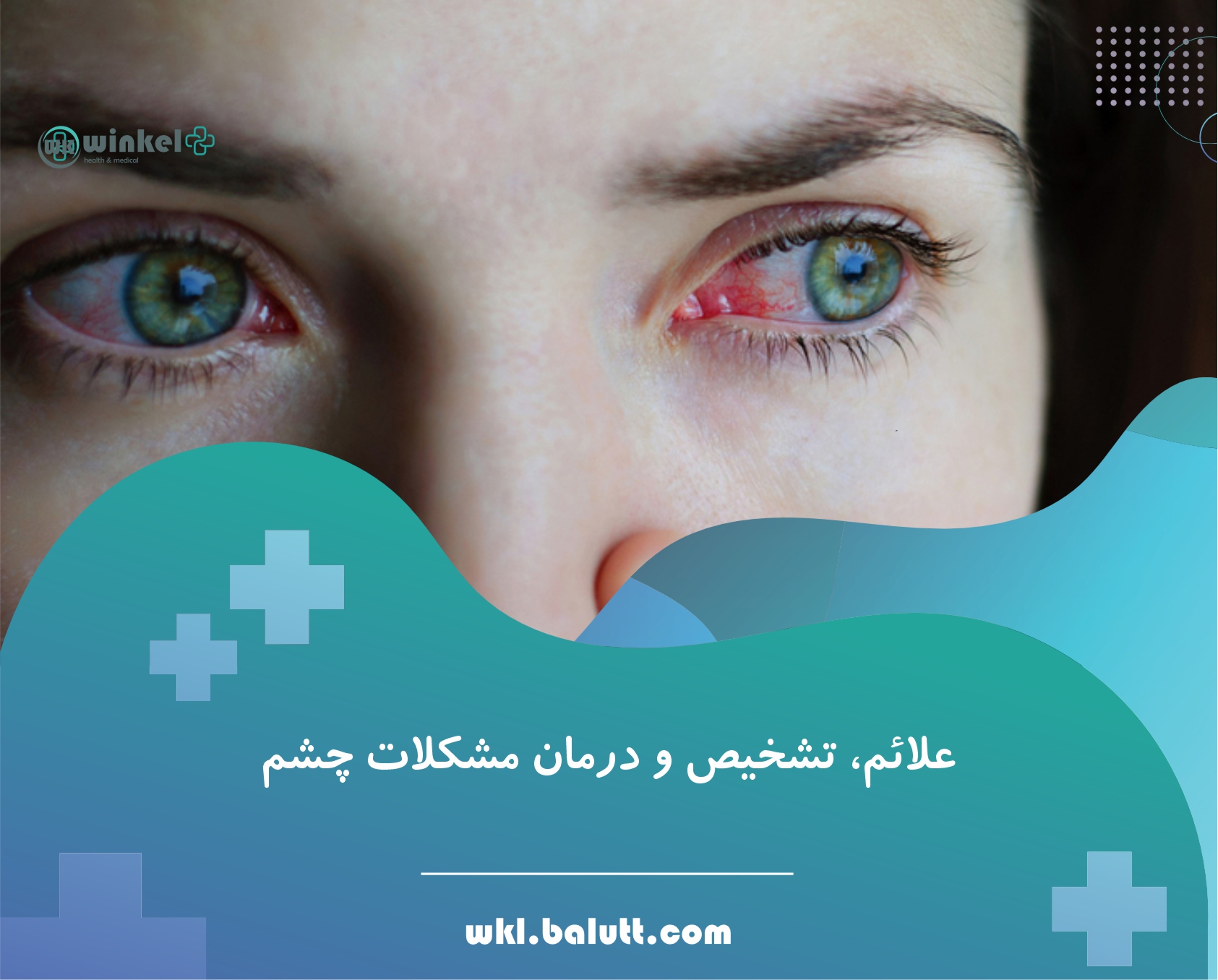 علائم، تشخیص و درمان مشکلات چشم
